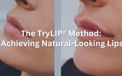 The TryLIP® Method: Achieving Natural-Looking Lips