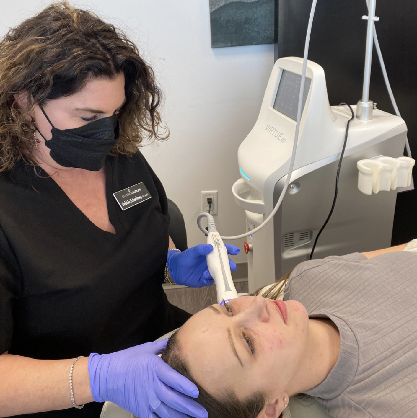 An Esthetic Solutions laser technician using the VirtueRF Microneedling treatment on a patient.