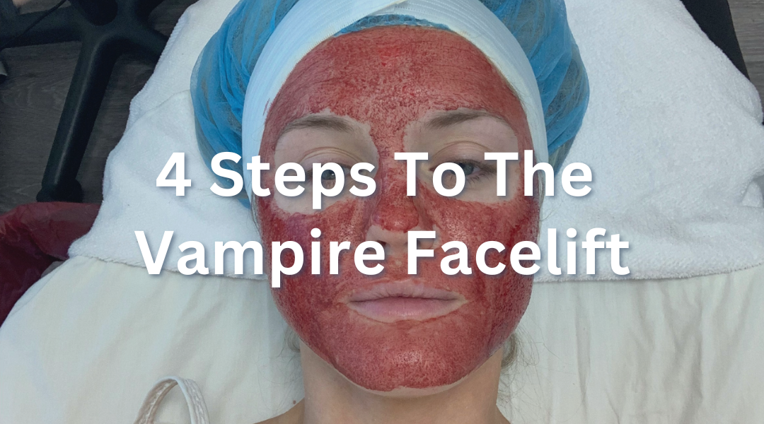 4 Steps to the Vampire Facelift