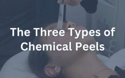 The Three Types of Chemical Peels