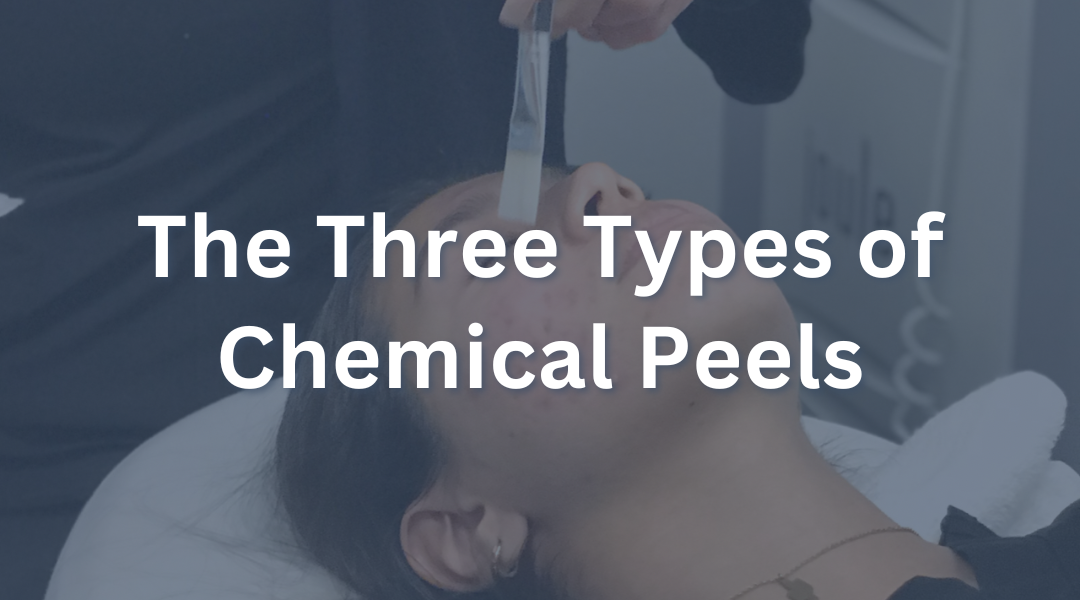 The Three Types of Chemical Peels