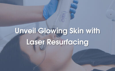 Unveiling Glowing Skin with Laser Skin Resurfacing