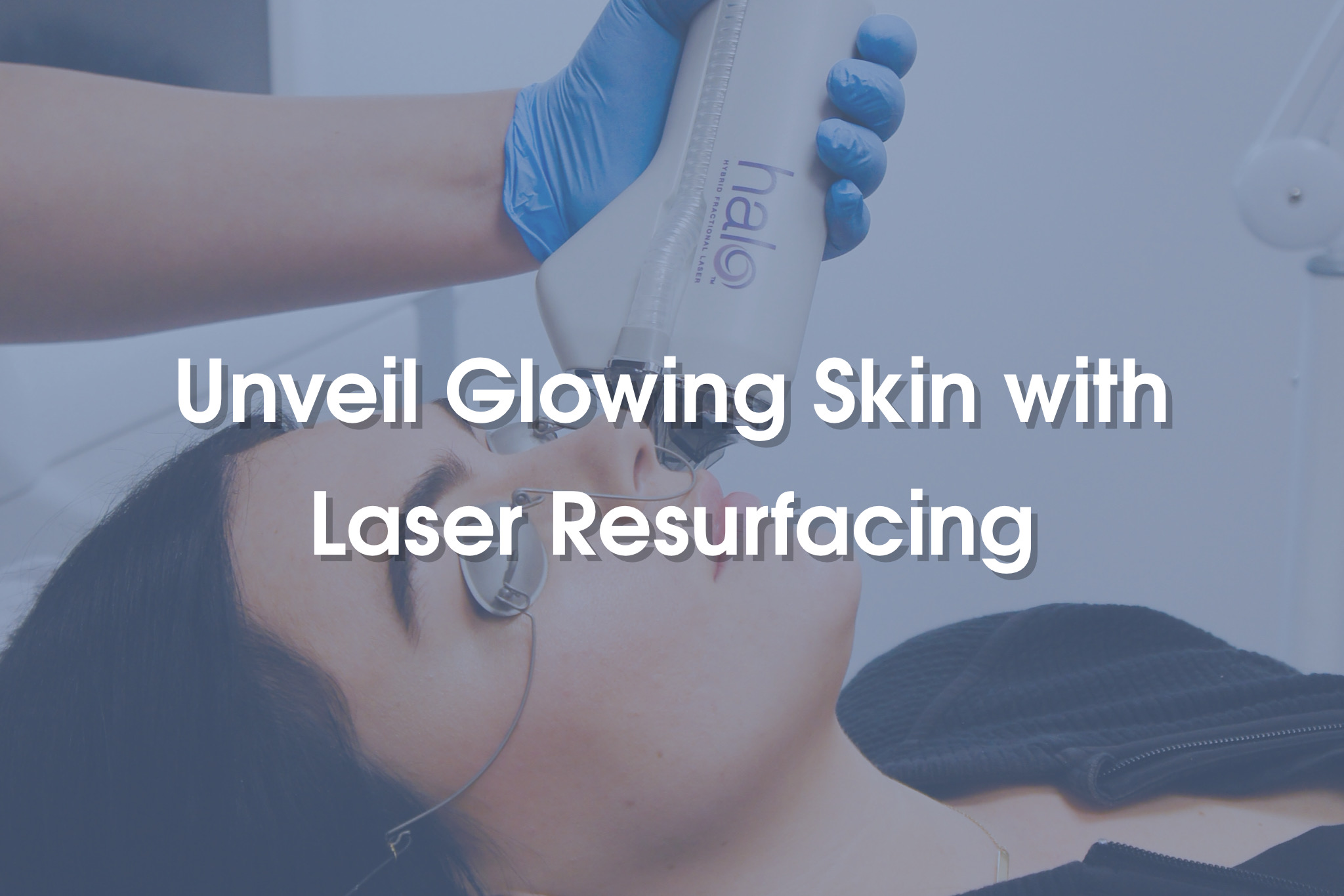 Unveiling Glowing Skin with Laser Skin Resurfacing